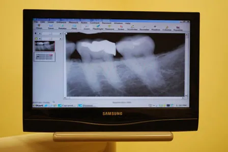 digital-xray